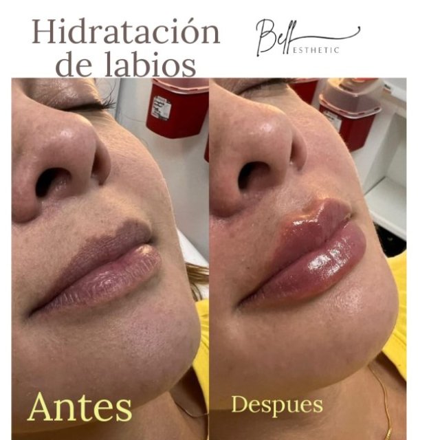 Centro de Medicina estética y láser en Lima Norte